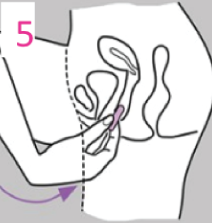 instrucciones de inserción de supositorios vaginales